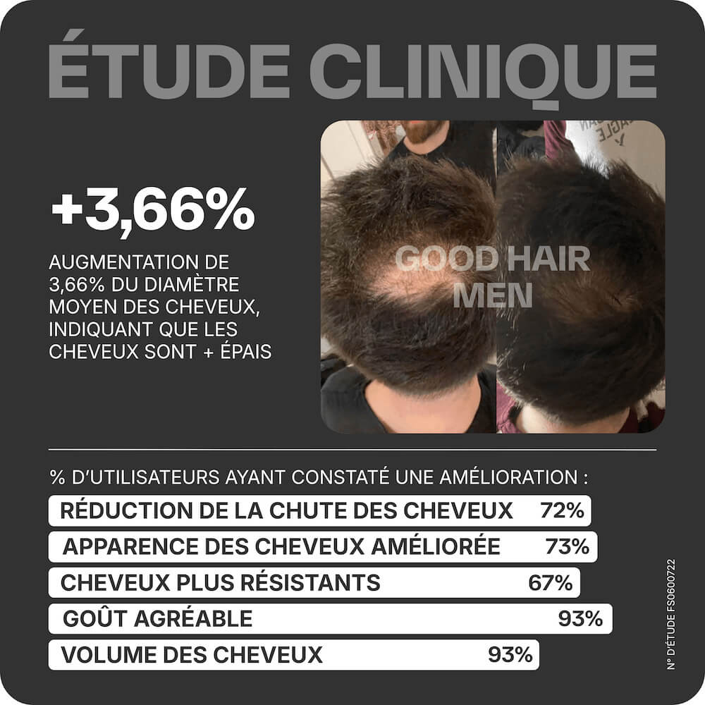Good Hair Men Anti-Haarausfall-Behandlung für Männer – 6 Monate