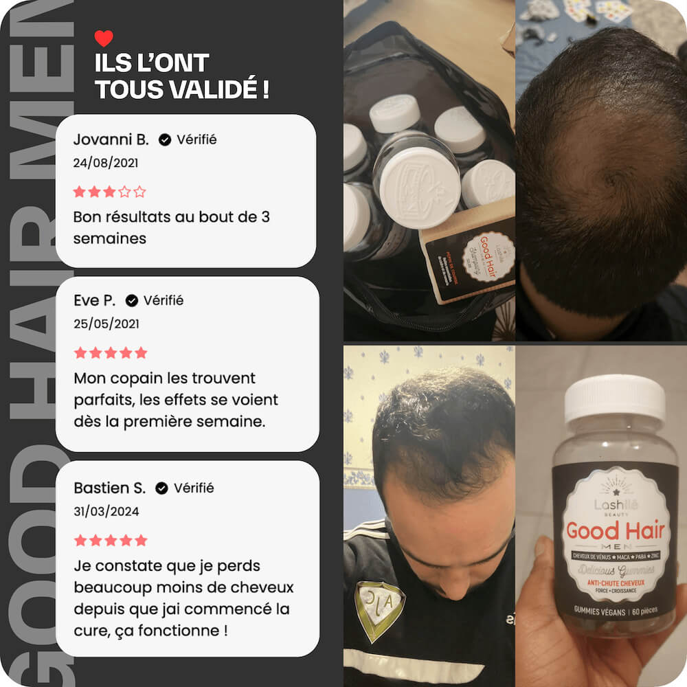 Good Hair Men Anti-Haarausfall-Behandlung für Männer – 6 Monate