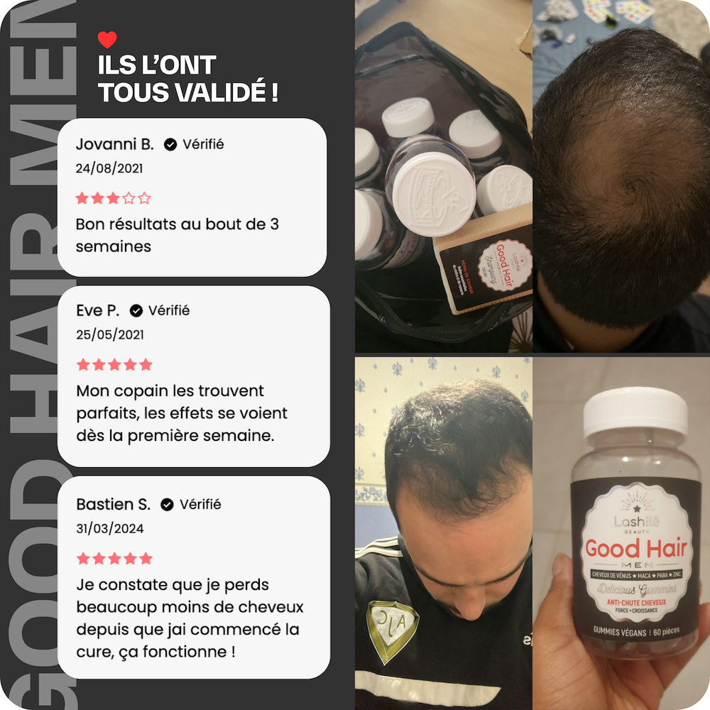 Good Hair Men Anti-Haarausfall-Behandlung für Männer – 3 Monate