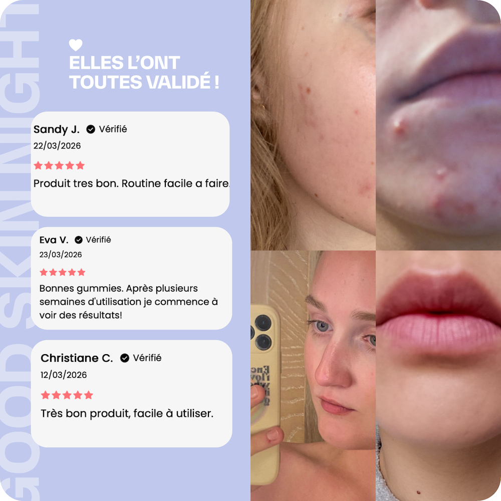 Good Skin Night - 6 months